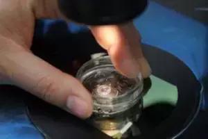 试管婴儿冻胚胎