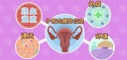 内膜异位症试管婴儿 内膜异位症试管婴儿