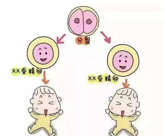 试管婴儿和自然怀孕有什么不同 试管婴儿和自然怀孕有什么不同