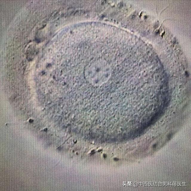 试管婴儿受精卵 试管婴儿受精卵