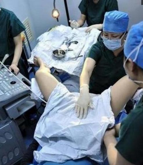 试管婴儿取卵过程