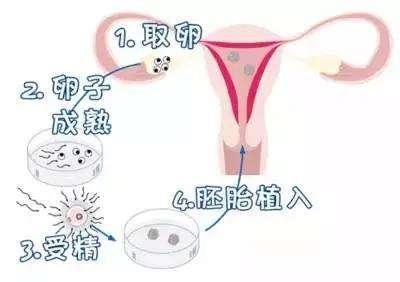 试管婴儿费用大约是多少