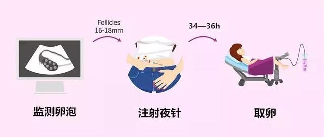 山东医院做试管婴儿山东可以做试管婴儿的医院