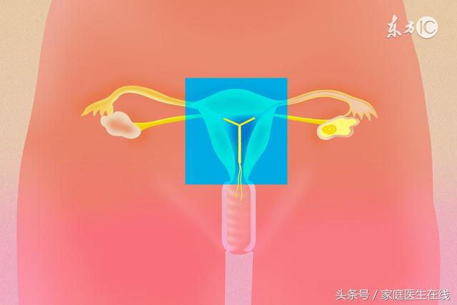 三代试管婴儿做双胞胎