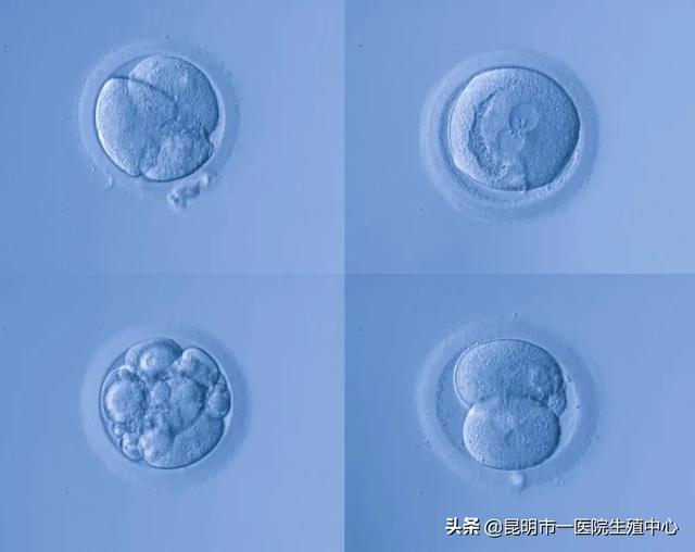 试管婴儿卵泡多大适宜试管婴儿促排卵针打多久