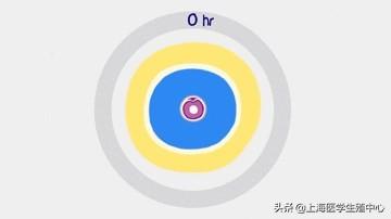 试管婴儿检查步骤 试管婴儿检查步骤