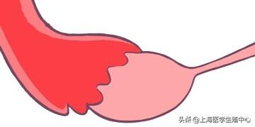 试管婴儿检查步骤 试管婴儿检查步骤