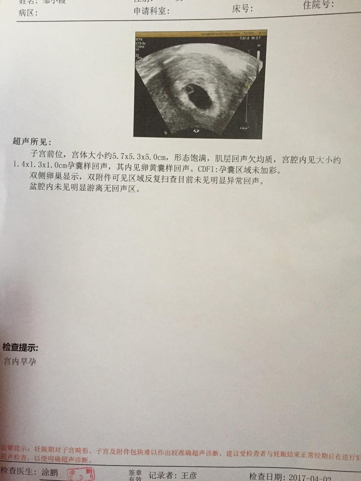 试管婴儿一超(试管婴儿最大的缺点是)