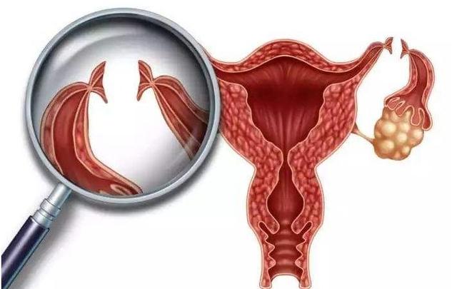 结扎还可以做试管婴儿 结扎还可以做试管婴儿
