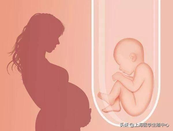 染色体异常试管婴儿 染色体异常试管婴儿