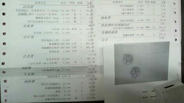 做几次试管婴儿 做几次试管婴儿