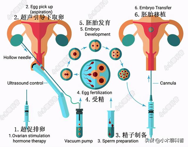 试管婴儿指啥 试管婴儿指啥