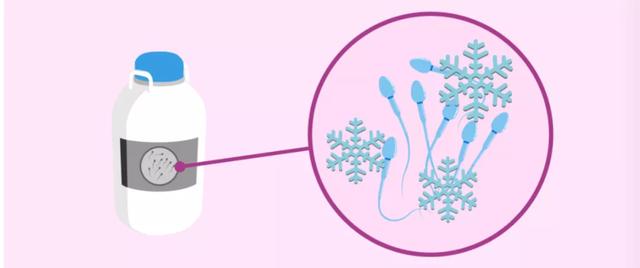 冷冻精子对试管婴儿 冷冻精子对试管婴儿
