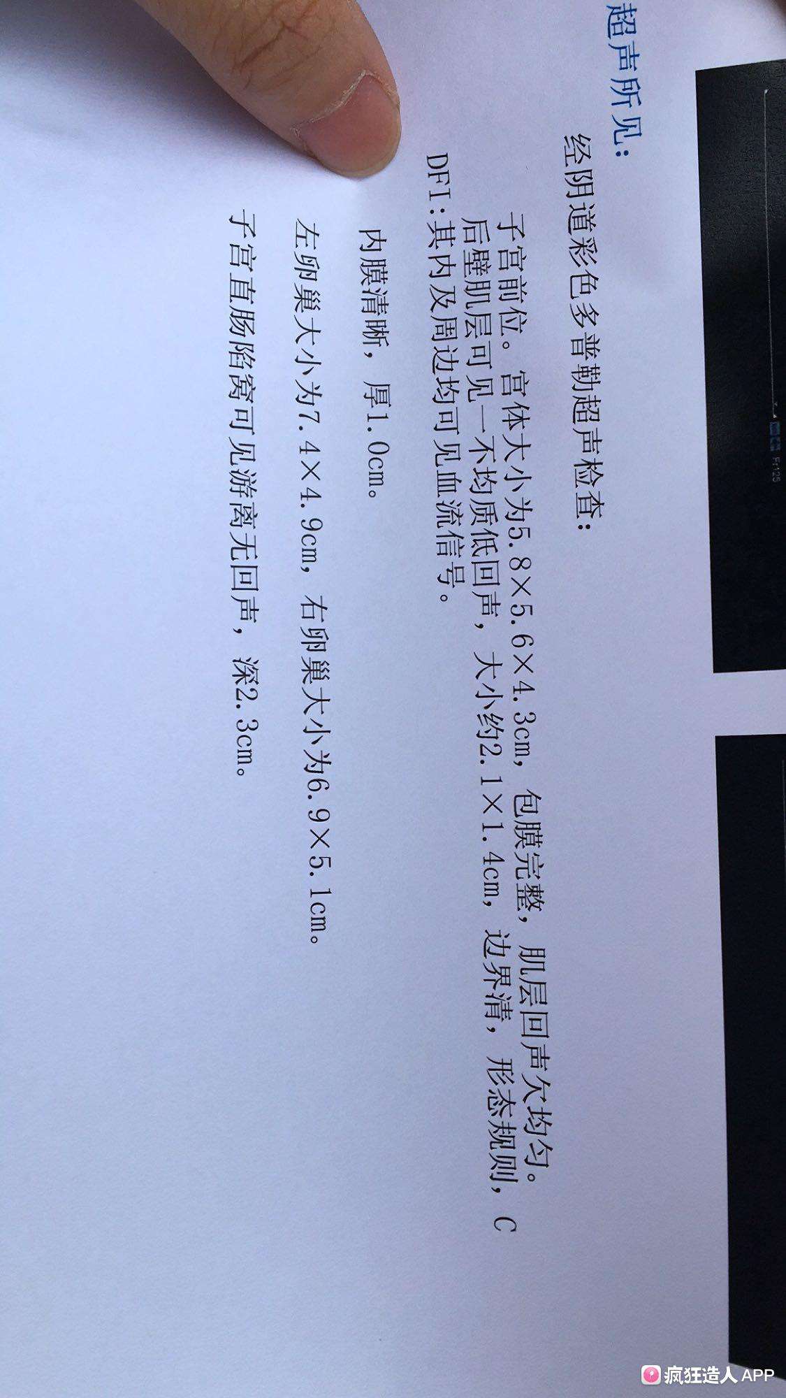 试管婴儿盆腔积液(试管移植后盆腔积液怎么办)