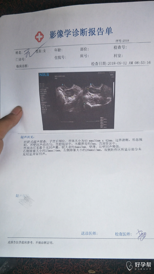 试管婴儿盆腔积液(试管移植后盆腔积液怎么办)