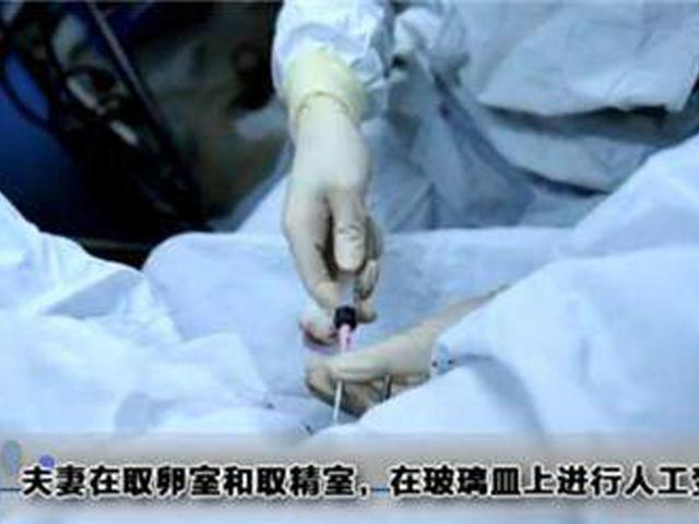试管婴儿放进子宫图(试管移植放入过程)