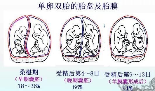 试管婴儿双胞胎第二代 试管婴儿双胞胎第二代