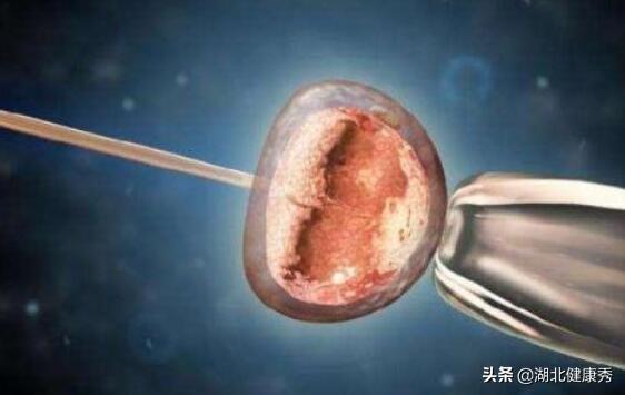 试管婴儿几月份移植成功率高冬天移植成功率高不高