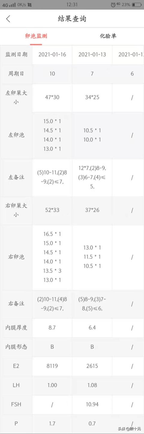 试管婴儿打排卵针要打多久 试管婴儿打排卵针要打多久
