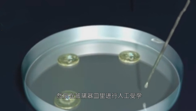 试管婴儿一个 试管婴儿一个