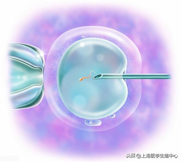 试管婴儿二代的成功率第二代试管婴儿的过程
