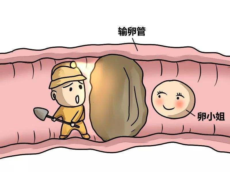 结扎可以做试管婴儿吗(已经结扎可以做试管吗)
