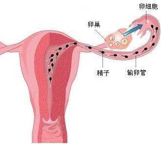 只试管婴儿吗 只试管婴儿吗