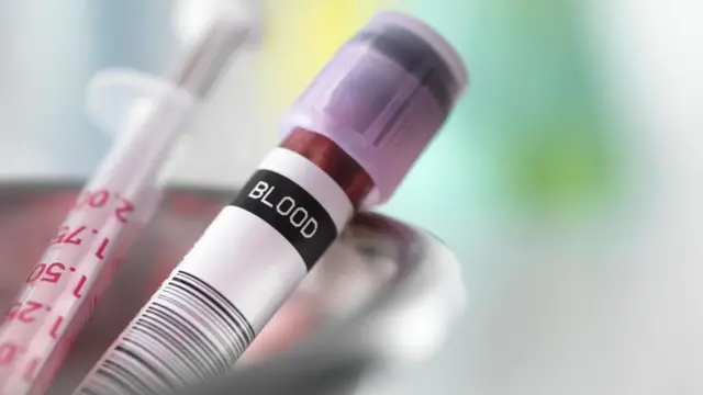 卵巢多囊做试管婴儿 卵巢多囊做试管婴儿