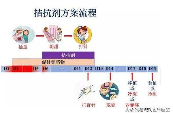 试管婴儿抗剂方案试管婴儿抗拮剂方案