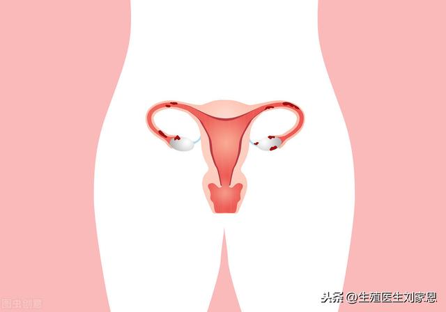 内膜薄试管婴儿(试管婴儿做一次多少钱)