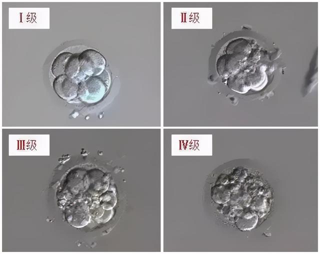松弛试管婴儿什么是试管婴儿