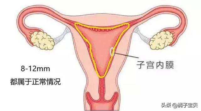 试管婴儿内膜薄 试管婴儿内膜薄