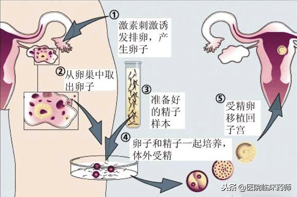 美国试管婴儿一次要多少钱 美国试管婴儿一次要多少钱