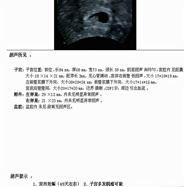 补佳乐试管婴儿 补佳乐试管婴儿
