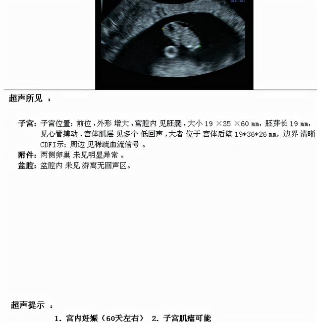 补佳乐试管婴儿 补佳乐试管婴儿