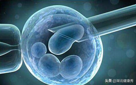 试管婴儿第12天 试管婴儿第12天