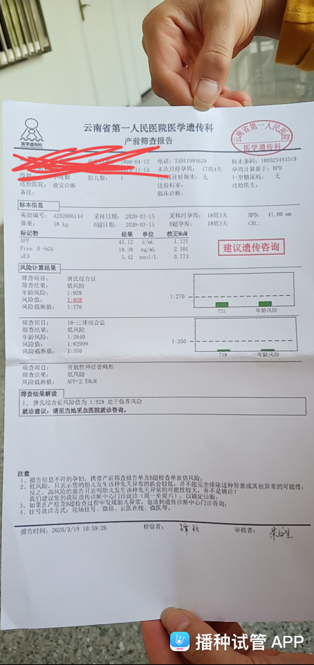 试管婴儿唐氏儿吗(三代试管可以避免唐氏儿吗)