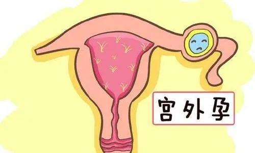 试管婴儿胖 试管婴儿胖