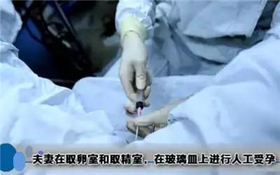 试管婴儿最全详细流程