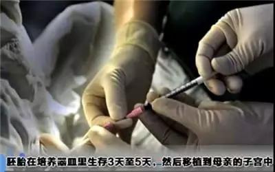试管婴儿最全详细流程