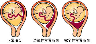 好一点的试管婴儿医院 好一点的试管婴儿医院