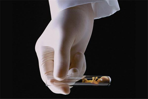 试管婴儿经验分享试管婴儿成功经验分享