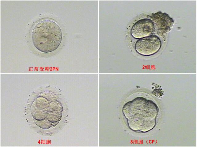 试管婴儿囊胚和冻胚