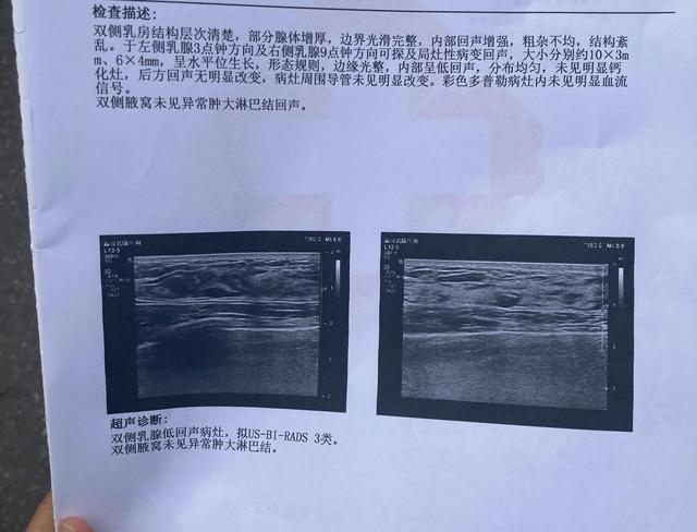 试管婴儿提成 试管婴儿提成