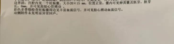 试管婴儿提成 试管婴儿提成