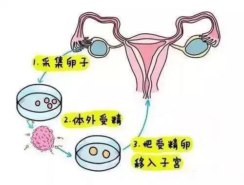 双胞胎试管婴儿的费用