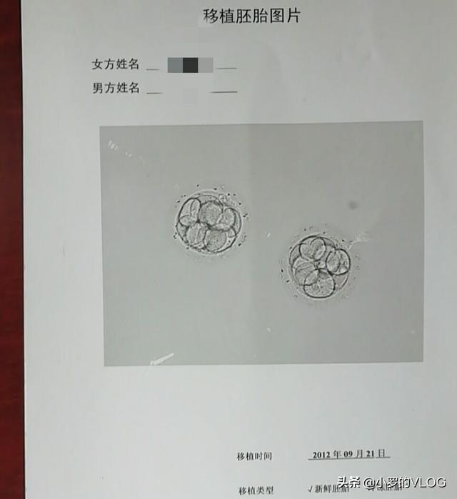 试管婴儿夫妻 试管婴儿夫妻