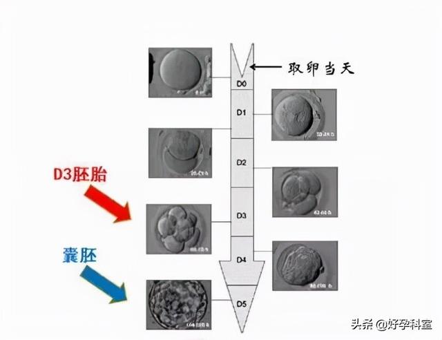 什么条件给做试管婴儿 什么条件给做试管婴儿
