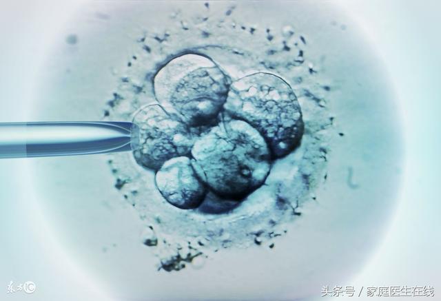 人工受精跟试管婴儿有什么区别人授跟试管的区别
