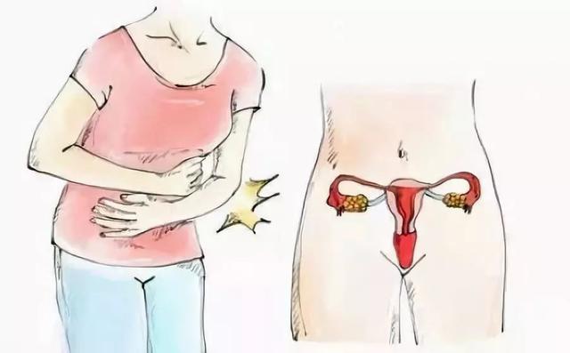 宫腔粘连对试管婴儿 宫腔粘连对试管婴儿